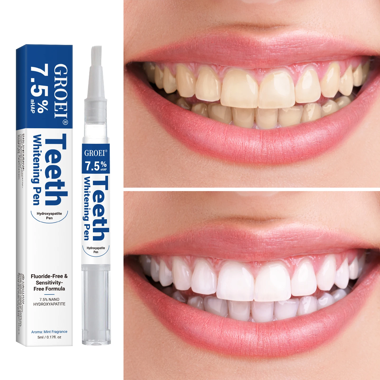 Гидроксипатитовая ручка для от – обзор и цена Teeth Whitening Q&M