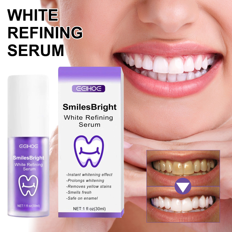 Очищение зубов, отбеливающая з – обзор и цена Teeth Whitening In Korea