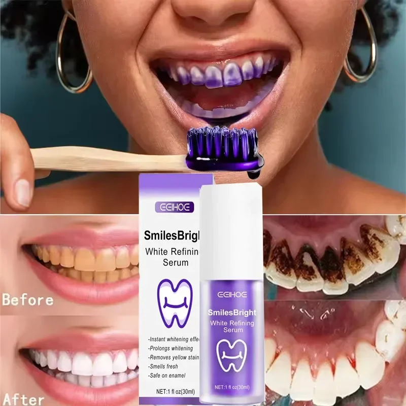 Очищение зубов, отбеливающая з – обзор и цена Teeth Whitening In Korea