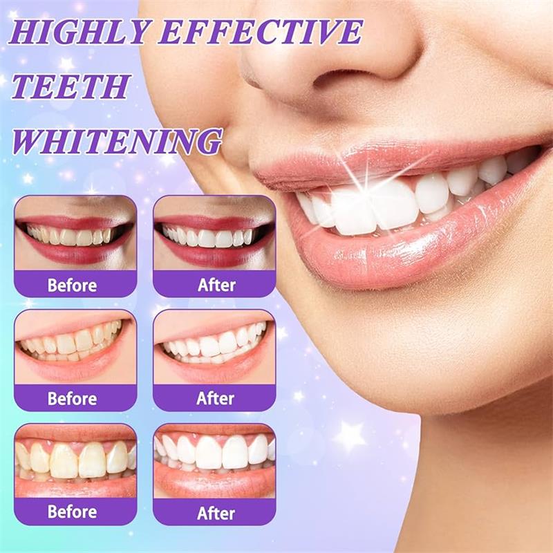 Зубная паста-мусс 9D Purple дл – обзор и цена Teeth Whitening Treatment