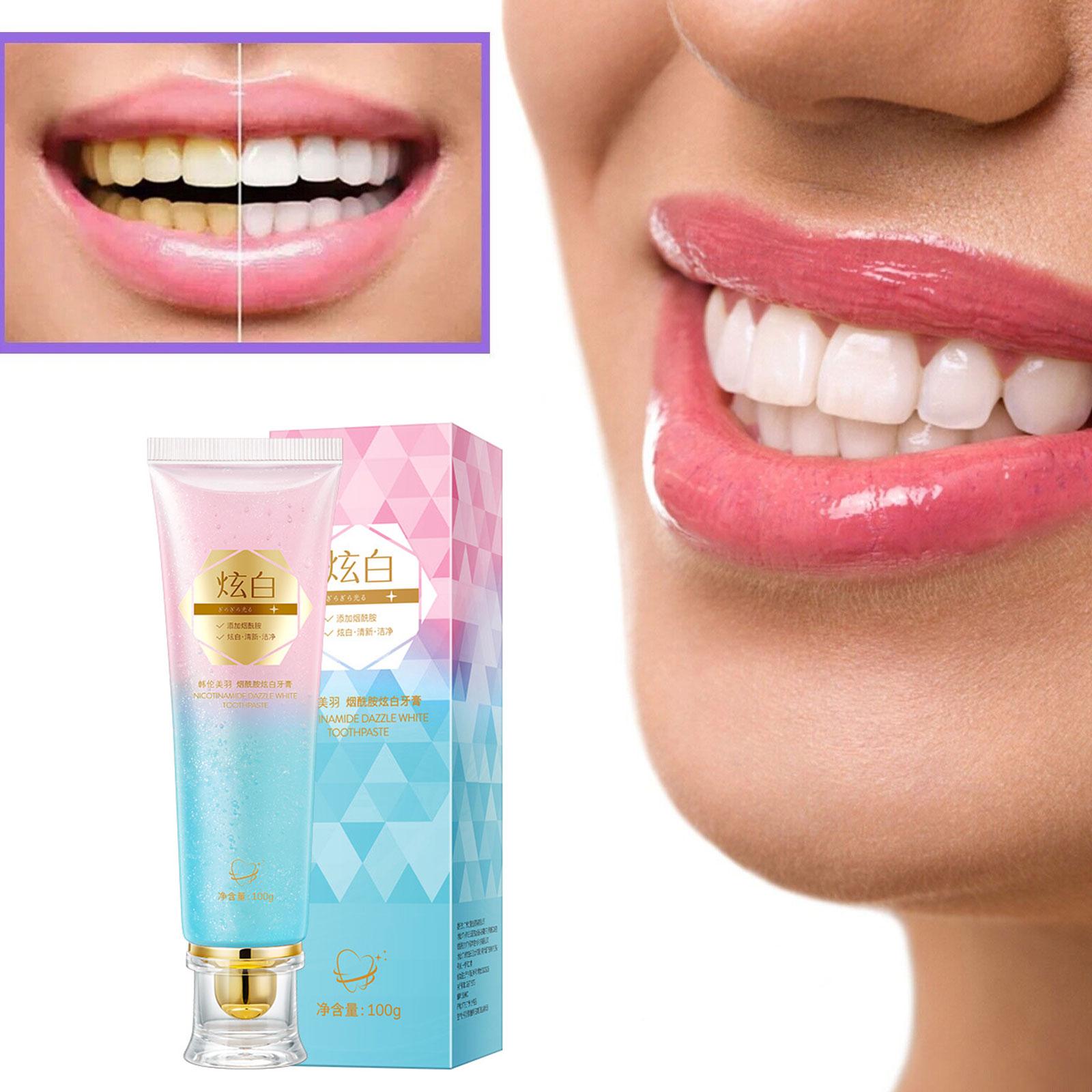 Ниацинамидная отбеливающая зуб – обзор и цена Teeth Whitening Treatment
