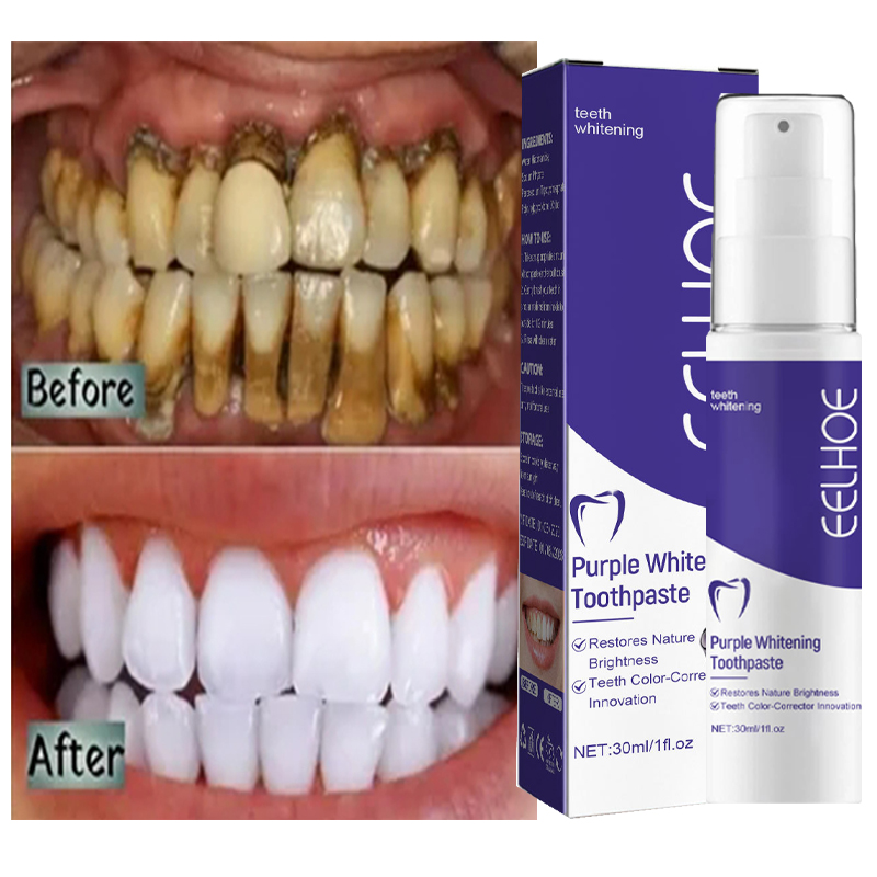 1 шт. зубная паста для Очищающ – обзор и цена Teeth Whitening In Korea