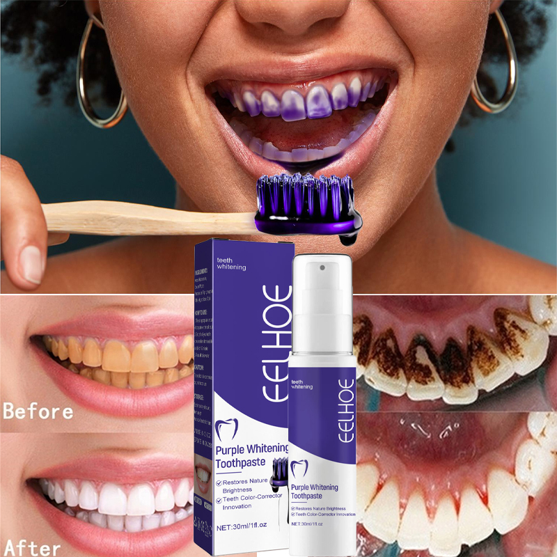 1 шт. зубная паста для Очищающ – обзор и цена Teeth Whitening In Korea
