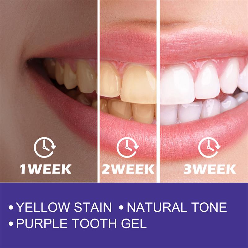 1 шт. зубная паста для Очищающ – обзор и цена Teeth Whitening In Korea