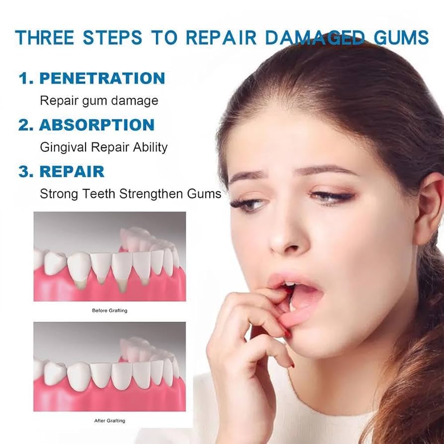 Быстрое восстановление десен,  – обзор и цена Teeth Whitening Treatment