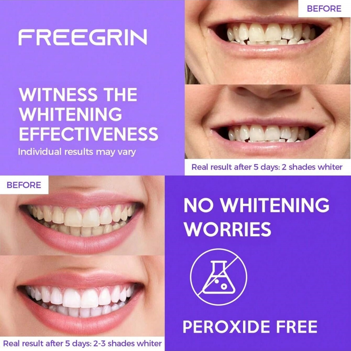 Роскошные отбеливающие наклейк – обзор и цена Teeth Whitening Q&M